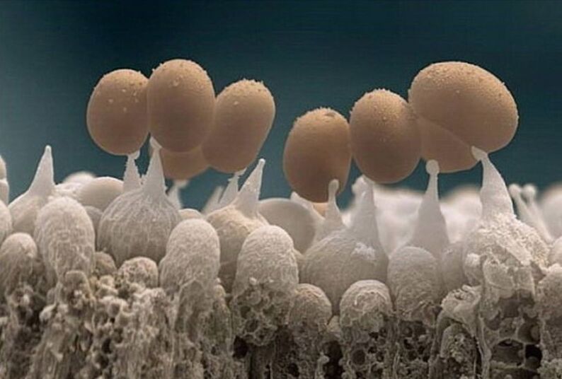 huba nechtov na nohách pod mikroskopom